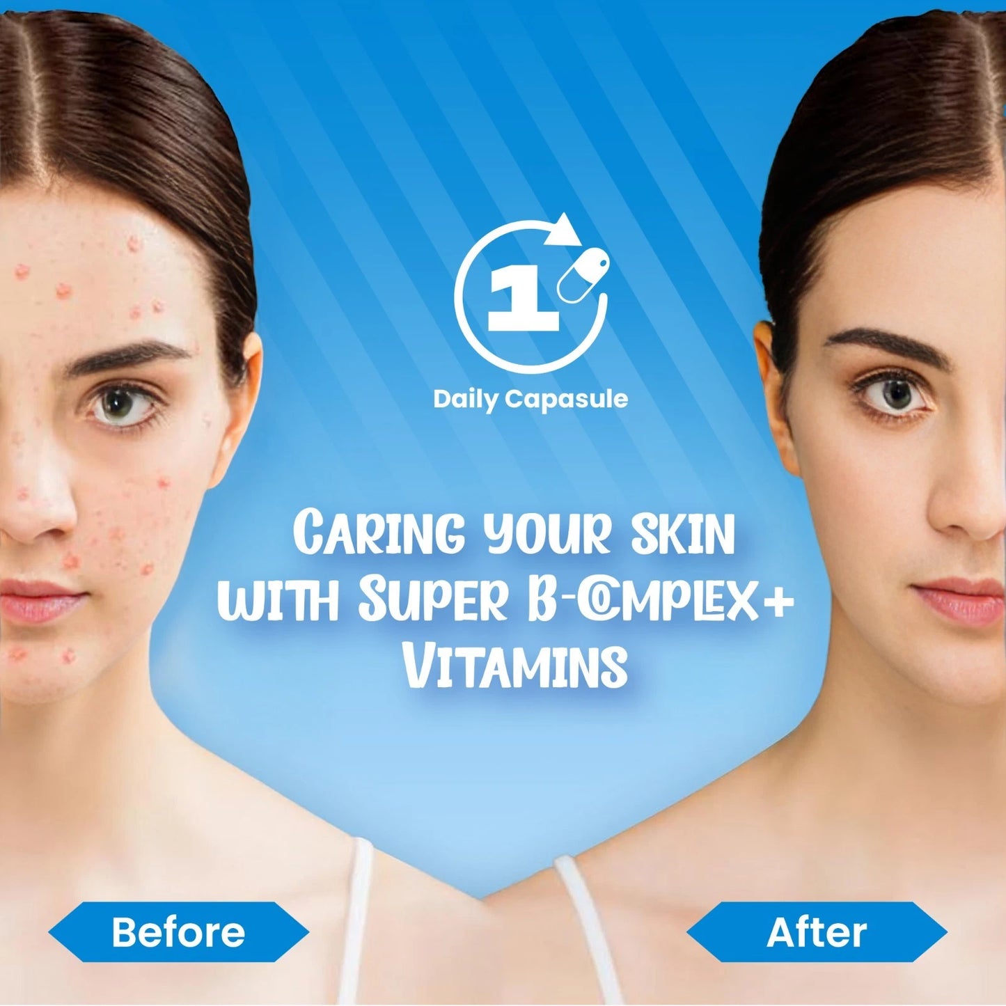 Nutrian B Complex+ – High Strength Energy, Nerve & Skin Support - 60 Veg Capsules